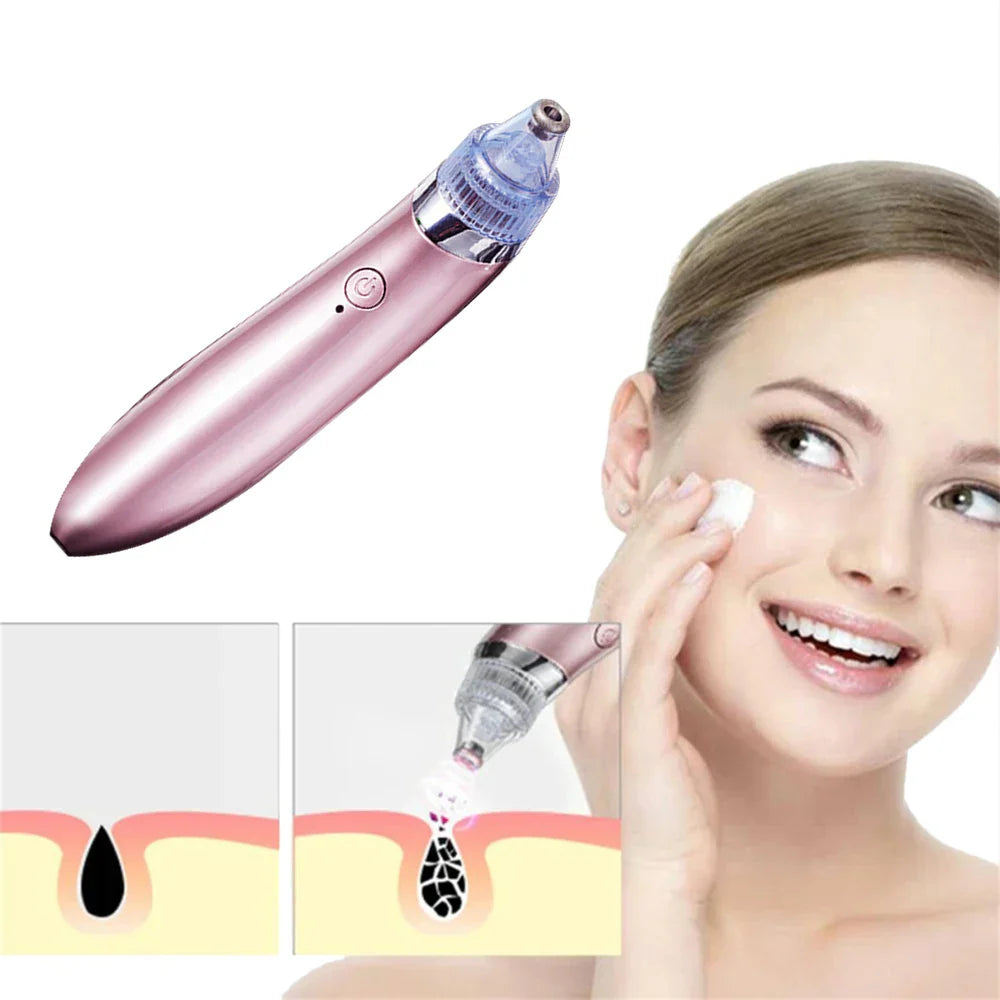 Heavenly Gadget Multifunctional 4 in 1 Beauty Pore Vacuum