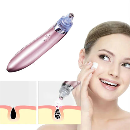 Heavenly Gadget Multifunctional 4 in 1 Beauty Pore Vacuum