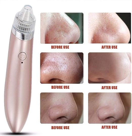Heavenly Gadget Multifunctional 4 in 1 Beauty Pore Vacuum