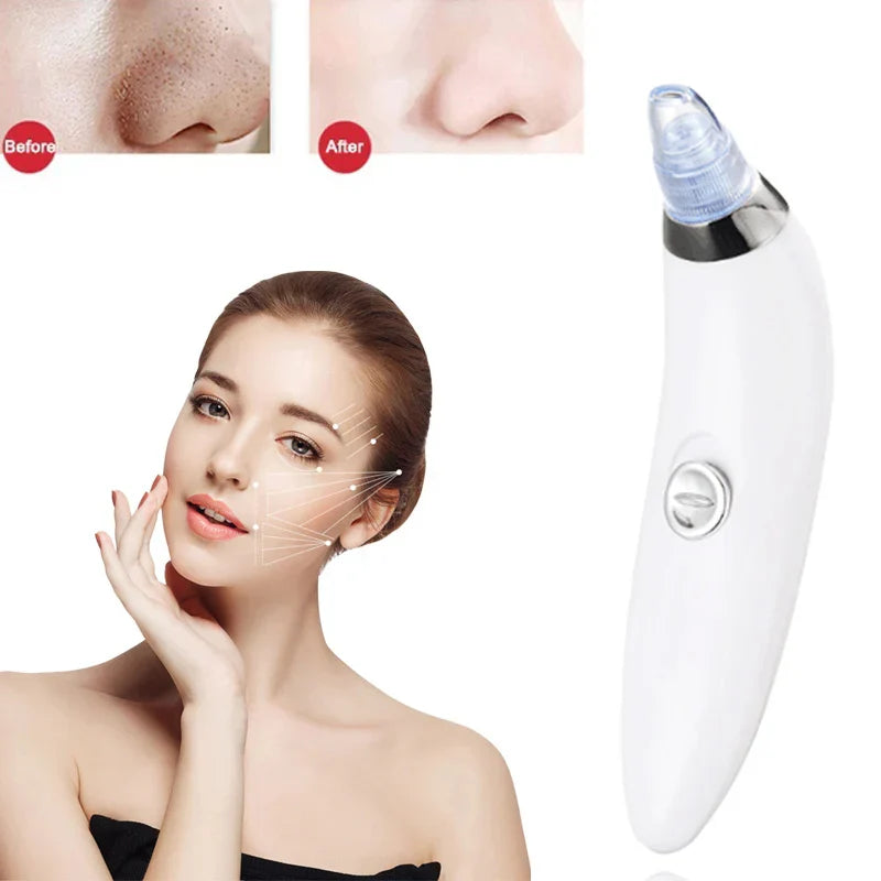 Heavenly Gadget Multifunctional 4 in 1 Beauty Pore Vacuum