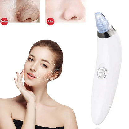 Heavenly Gadget Multifunctional 4 in 1 Beauty Pore Vacuum